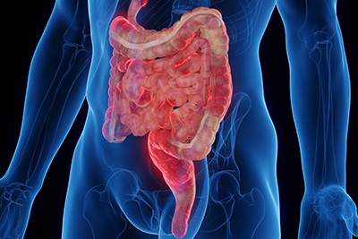 Is inflammatory bowel disease the same thing as IBS?