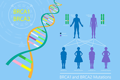 My Story with the BRCA2 Variant