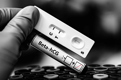 Use of HCG (human Chorionic Gonadotropin) to Prevent Testicular Shrinkage