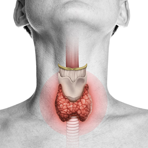 Hypothyroidism